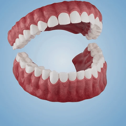 Gebis med naturtro farve og form, komplet sæt til over- og underkæbe for et diskret og smukt smil.