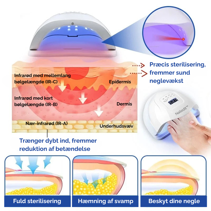 Fodpleje og behandling af neglesvamp med denne innovative laser. Giver sunde, flotte negle.