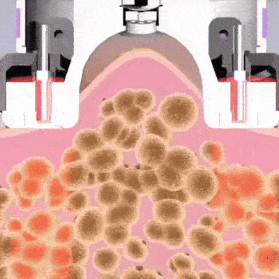 RadiancePulse massageapparat til reducering af cellulite og opstramning af huden med infrarød varme.