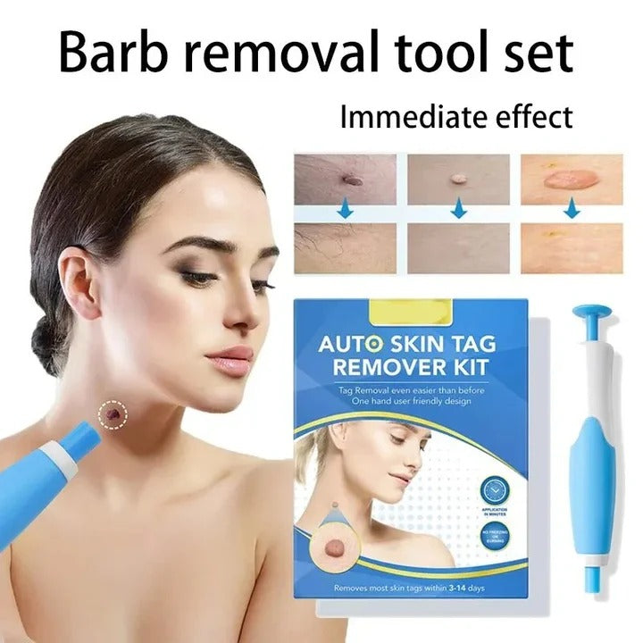 Nærbillede af SkinTagEase kit med applikator for effektiv og skånsom fjernelse af hudmærker.