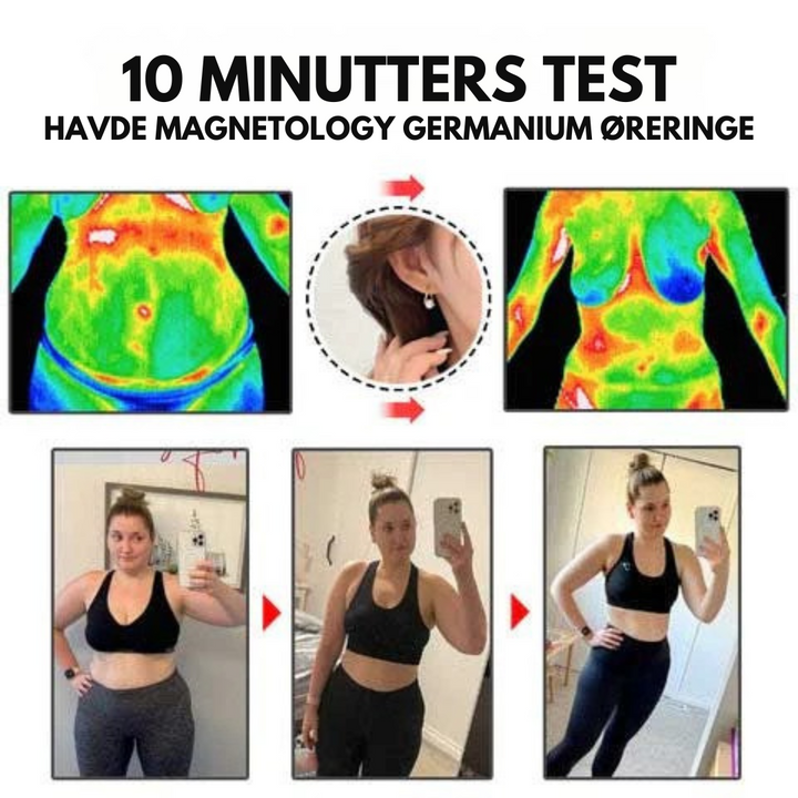 Wellness magnetøreringe, unisex, der understøtter cirkulation og vægttab.