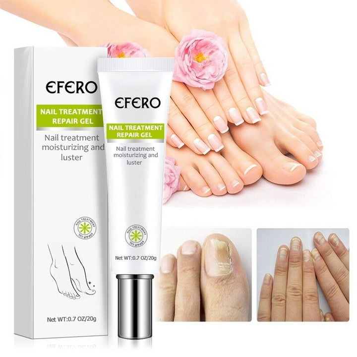 Unisex neglebehandling gel for sunde fingernegle og tånegle. Giver styrke og enestående glans.