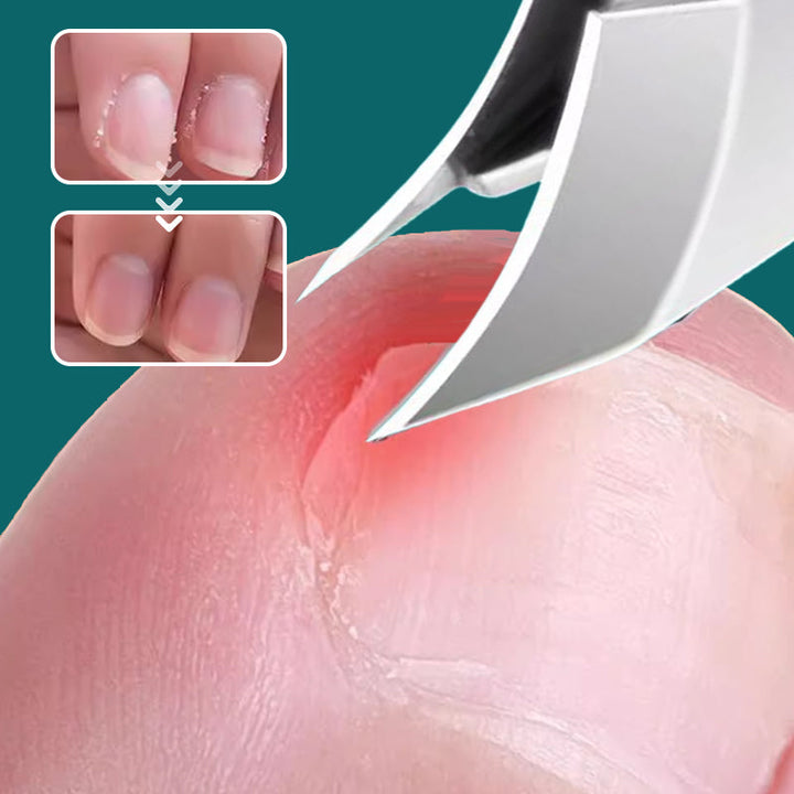 Rodfrit præcisions negleklippersæt i rustfrit stål til unisex neglepleje. Ideel til manicure/pedicure.